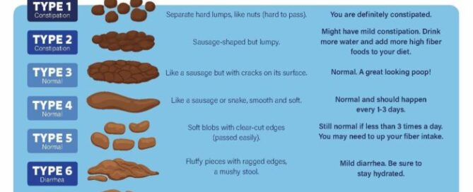 Bristol Stool Chart