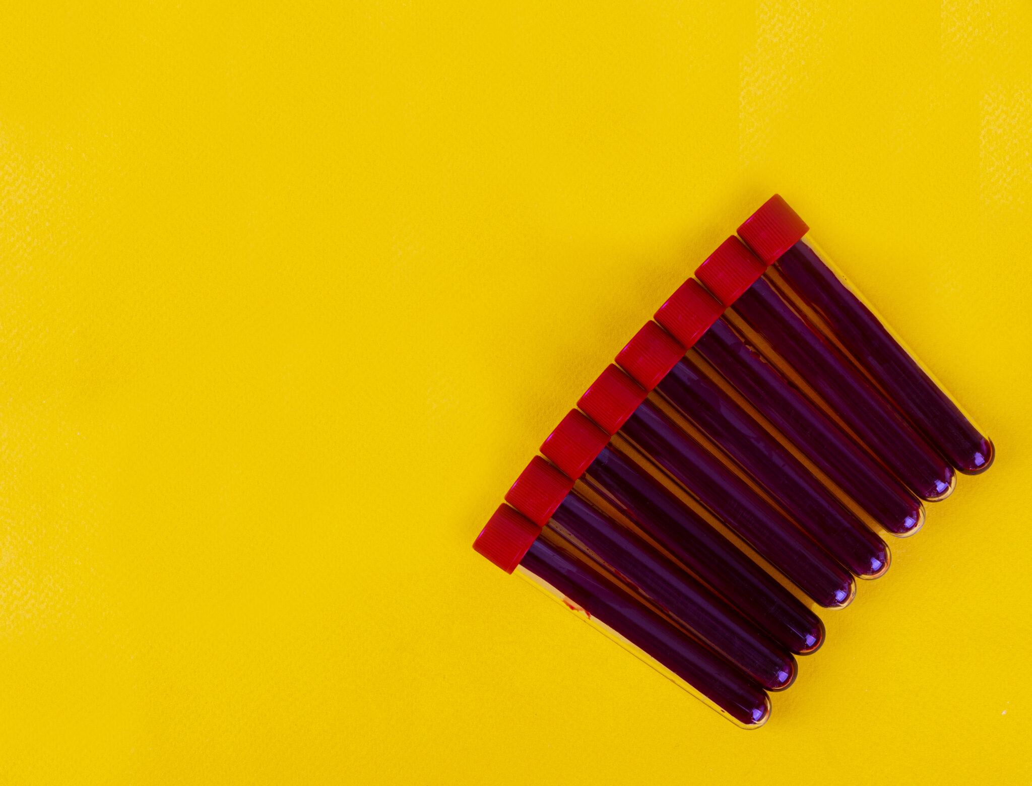 Screening in African American and Medically Underserved Communities